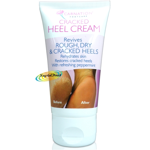 Carnation Heel Cream Rehydrates Dry Skin Restores Cracked Heels 50ml