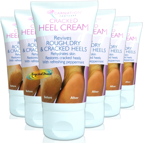 6x Carnation Heel Cream Rehydrates Dry Skin Restores Cracked Heels 50ml