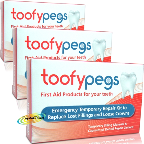 3x Toofypegs Tooth Repair Kit for Lost Fillings & Loose Crowns