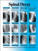 Spinal Decay X-ray Chart