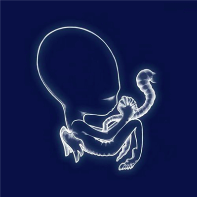 Sigur Ros - Agaetis Byrjun [2LP] - VINYL LP