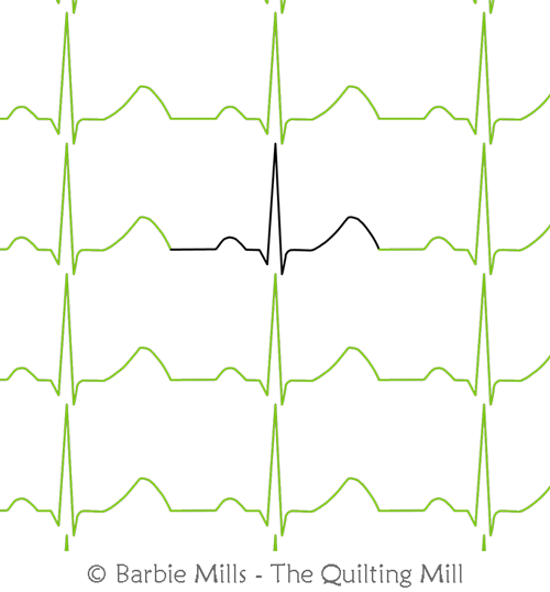 Normal Sinus ECG by The Quilting Mill. This image demonstrates how this computerized pattern will stitch out once loaded on your robotic quilting system. A full page pdf is included with the design download.