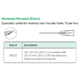 Visitec Membrane Micropick [Eaton], .90 x 25 mm (20G x 1 in) cannula. MFID: 585212