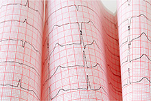 Chart Paper for Quinton Q-Stress System, Z-Fold, Full Grid, 8&#189;" x 11", 200/pad, 10 pad/case. MFID: 036869-001