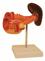 Diseased Pancreas with Duodenum and Spleen Model