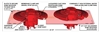 Mifab R1270-RG Combination Roof Drain