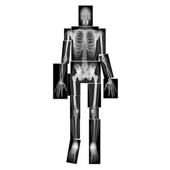 True To Life Human X-Rays By Roylco