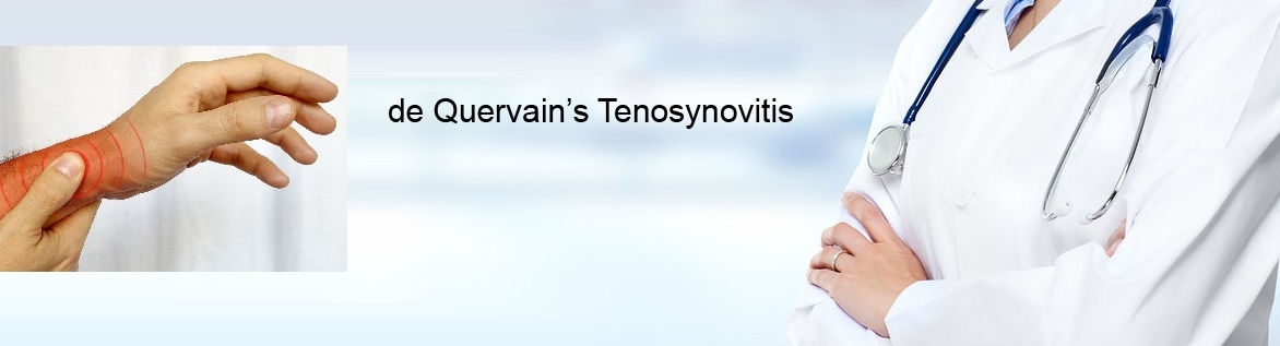 Best Brace for De Quervain's Tenosynovitis