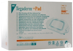 Tegaderm Transparent Film Dressing, 2" x 2.75", 50/BX