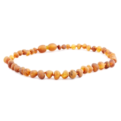 The Amber Monkey Baroque Baltic Amber 10-11 inch Necklace - Raw Cognac
