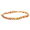 The Amber Monkey Baroque Baltic Amber 17-18 inch Necklace - Raw Cognac