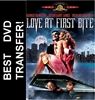 Love At First Bite DVD 1979
