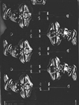 Crossed Ear Bunny Lolly Chocolate Mold - LPE036