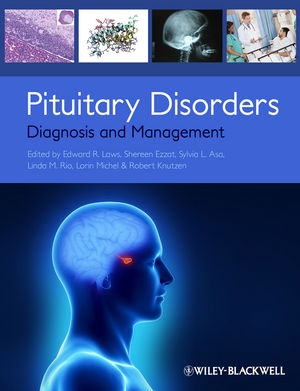 Pituitary Disorders:  Diagnosis and Management  (Available on Amazon.com)