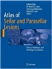 Atlas of Sellar and Parasellar Lesions; Clinical, Radiologic, and Pathologic Correlations