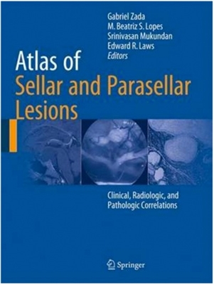 Atlas of Sellar and Parasellar Lesions; Clinical, Radiologic, and Pathologic Correlations